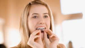 Woman using ClearCorrect aligners