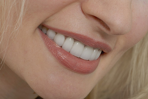 Cosmetic Dentistry Services at Mount Vista Family Dental in Vancouver WA